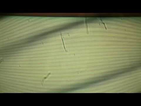 microfilariae movie (SCOB male)