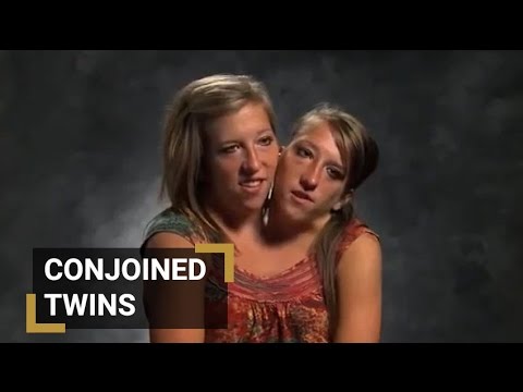 Abigail & Brittany Hensel - The Twins Who Share a Body - video Dailymotion