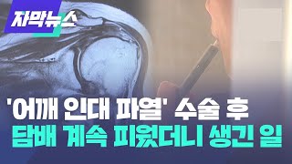 &#39;어깨 인대 파열&#39; 수술하고 담배 계속 피웠더니 생긴 일