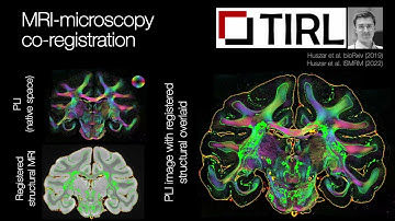 OHBM 2022 | 140 | Talk | Amy Howard | The BigMac dataset: linking tissue microstructure with MR si…