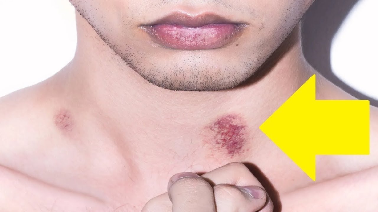 how to give a hickey for beginners easy tips - YouTube