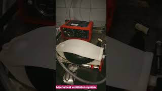 mechanical ventilation system | parapac ventilator | ventilator running without electricity