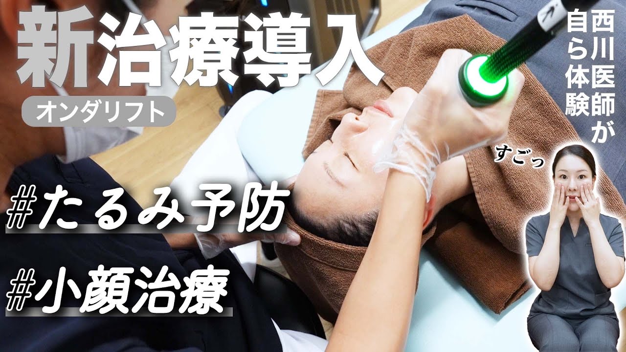 【オンダリフト】新小顔治療の解説と施術を公開します。