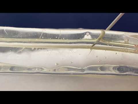 Arterial Catheter Placement