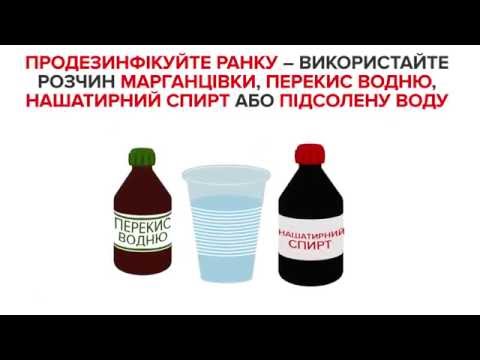 Коротко про головне. Що робити при укусі бджоли або оси