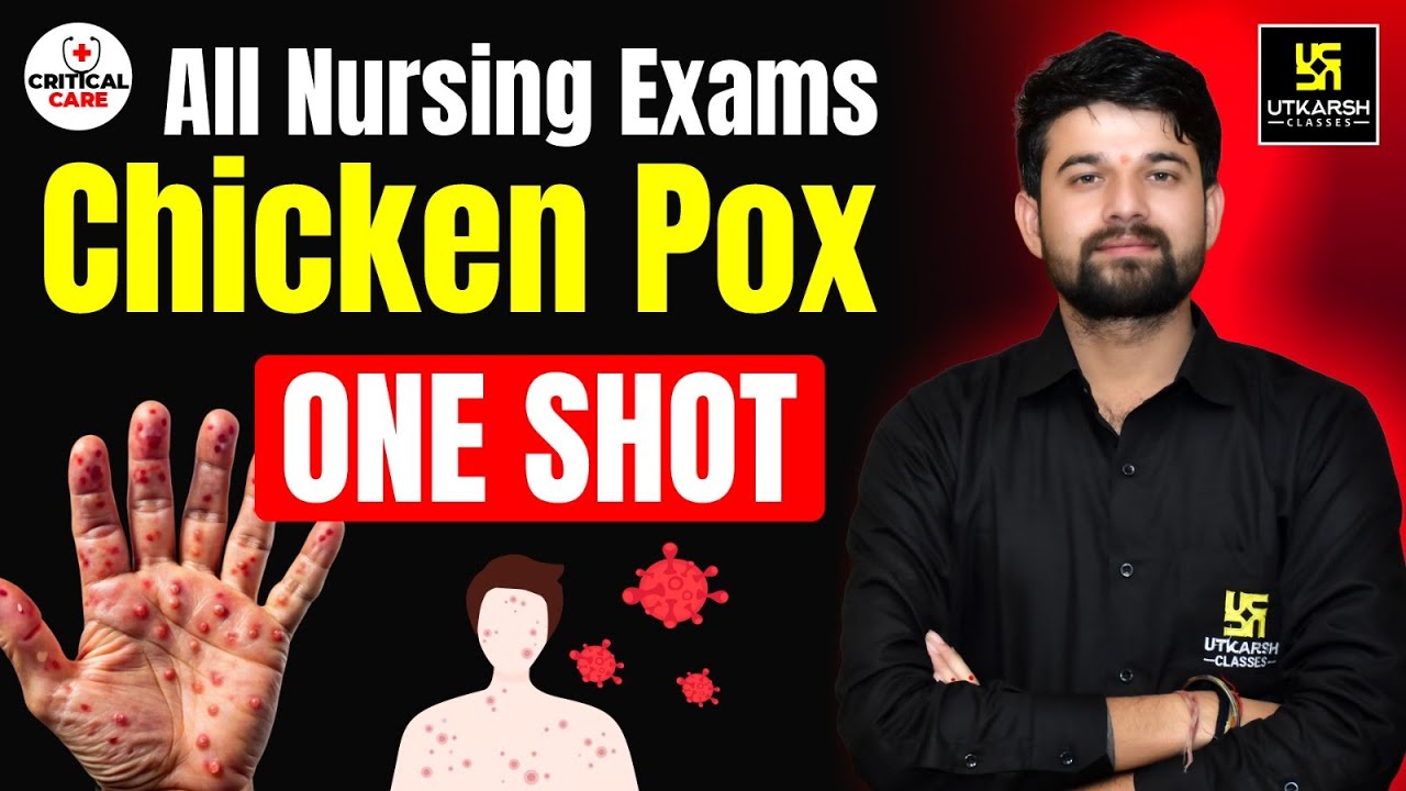 Chickenpox in One Shot | Causes, Symptoms & Treatment Explained | Critical Care Nursing | Sagar Sir
