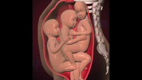 PRECIOUS MOMENTS OF TRIPLETS INSIDE THE WOMB  (3D ANIMATION)