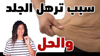 الحل لترهل الجلد مع التخسيس