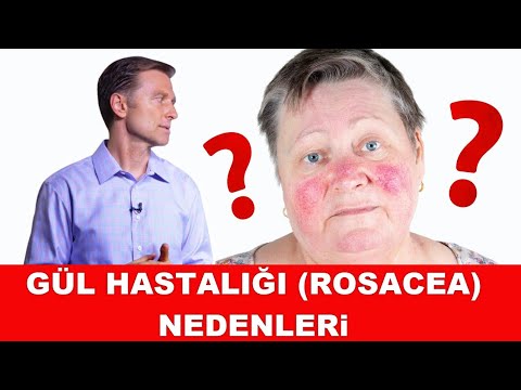 Video: Yaygın gül hastalıkları: belirtiler, olası nedenler ve korunma