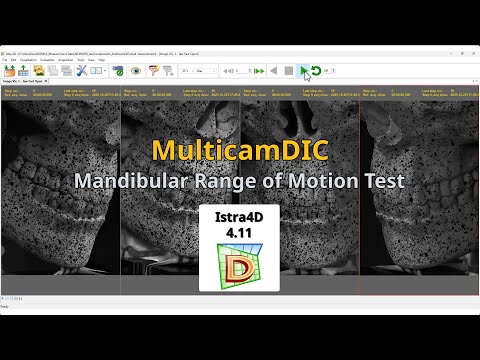 Mandibular Range of Motion Test with a 4-cam MulticamDIC system using Istra4D V4.11
