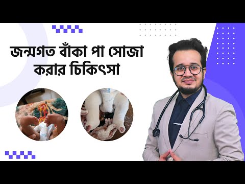 জন্মগত বাঁকা পা সোজা করার চিকিৎসা || সহকারী অধ্যাপক ডা: মোহাম্মদ ইফতেখার আলম