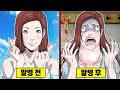 【만화】 몸이 붕괴되는 병... 눈알이 튀어나오고 손톱이 전부 갈라지다