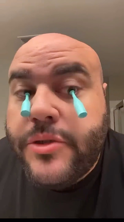 MY EYEBALL CAME OUT🙄#funny #tiktok #trending #shorts