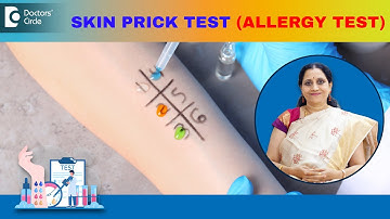 Allergy Skin Tests | SKIN PRICK TEST - How is it performed? - Dr.P Lakshmi Satish | Doctors