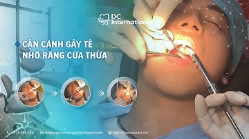 Cận Cảnh Gây Tê Và Nhổ Răng Cửa Thừa! Dr Cường