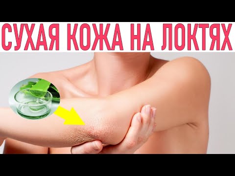 СУХОСТЬ КОЖИ НА ЛОКТЯХ | Почему кожа на локтях сухая и что с этим делать