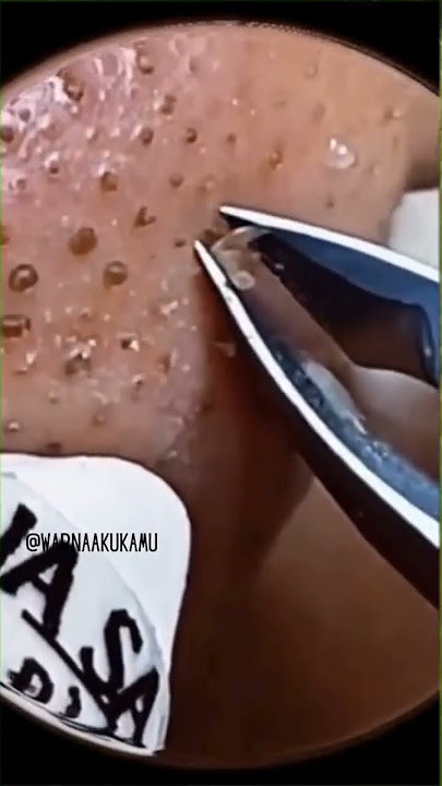 Pencet komedo a.k.a blackhead removal... #shorts #warnaakukamu #subscribe #blackpink #yearofyou #fyp