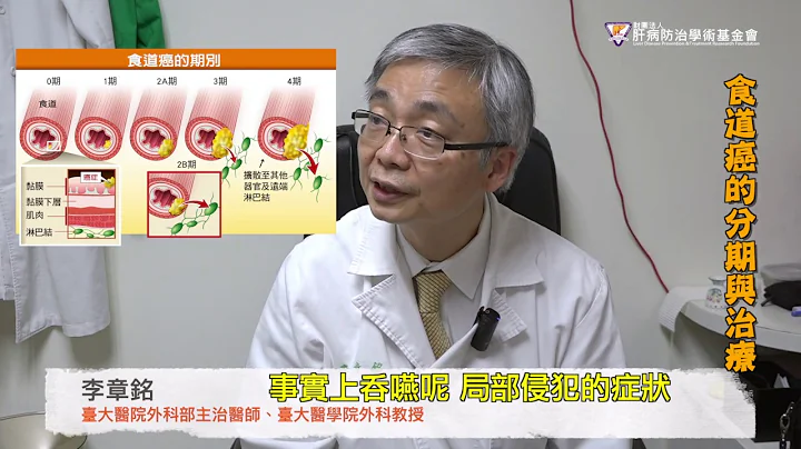 食道癌分期與治療 中晚期仍有長期存活機會 - 天天要聞