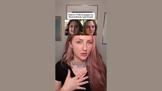 How C-PTSD Changed My Face and How I Got it Back