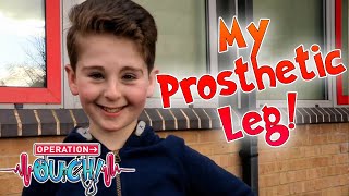 My Prosthetic Leg! Rio's Story | Science for Kids | Operation Ouch