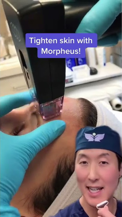 A New Way To Tighten Skin- Morpheus Radiofrequency Microneedling #shorts #morpheus