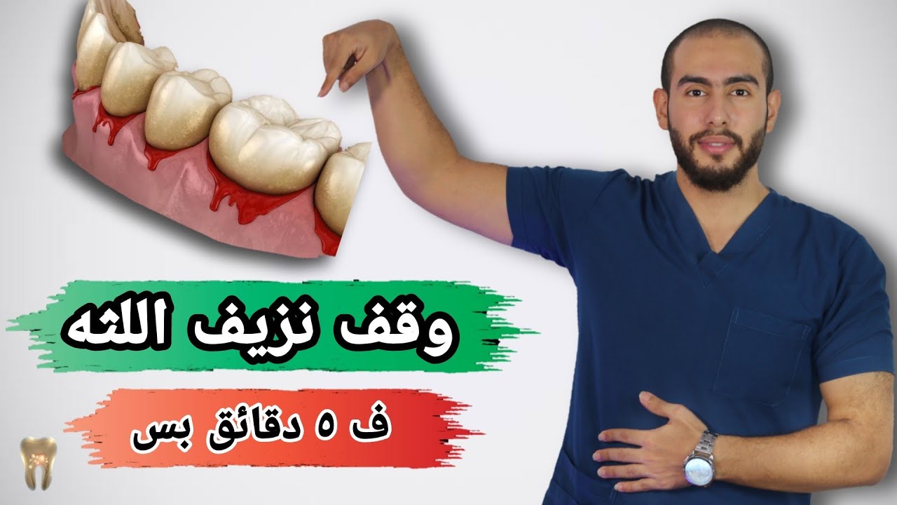 علاج نزيف اللثه فى ثوانى معدوده | علاج التهاب اللثه وانتفاخها | ليه بيحصل نزيف اللثه مع غسيل الاسنان