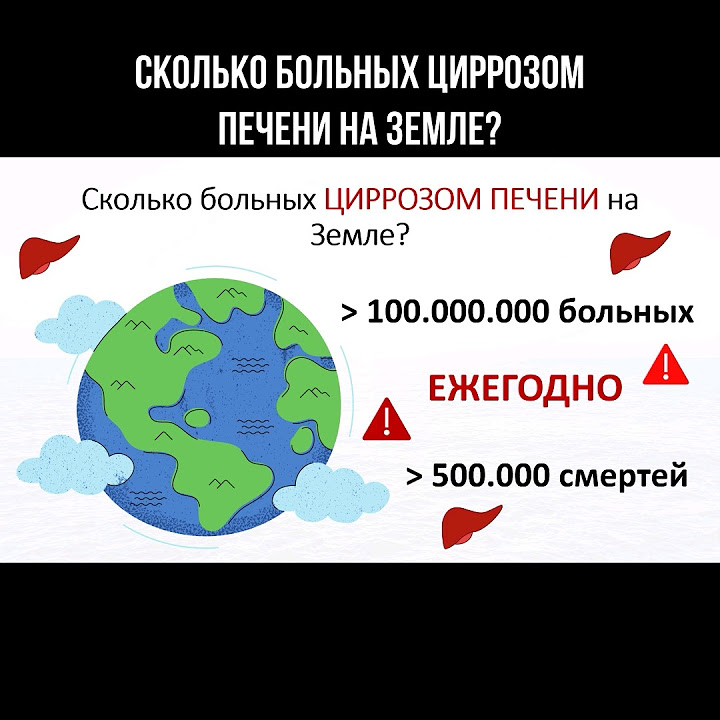 Сколько больных циррозом печени на Земле? #циррозпечени #цирроз # ...