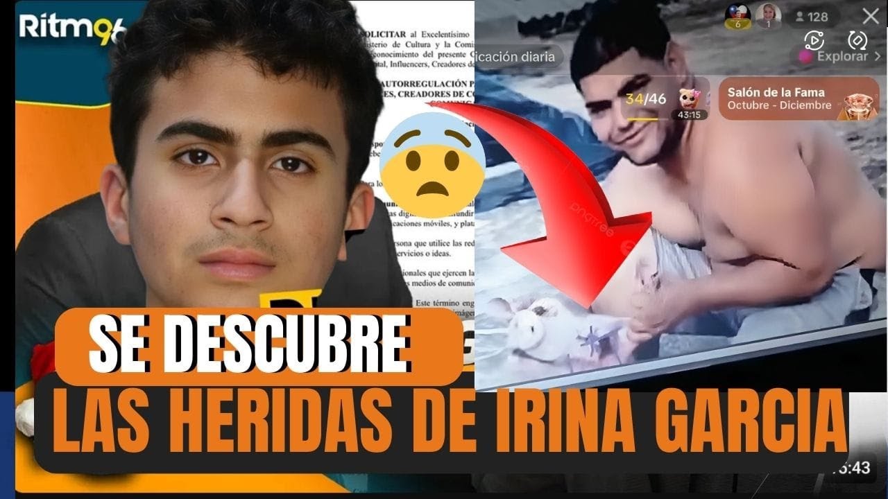 😮CASO DEREK ROSA SALEN IMAGENES IMPACTANTES DE LAS H3RIDAS DE IRINA ...