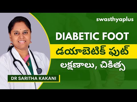 డయాబెటిక్ ఫుట్: ఎలా చికిత్స చేయాలి? | Diabetic Foot: How to Treat? in Telugu | Dr Saritha Kakani
