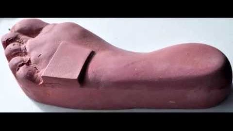 How to Capture Forefoot Valgus and Forefoot Varus intrinsically in a foam box cast