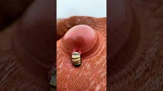 Warbleflycam Vlog Tiny Camera On Cattle Warble Hypoderma Larva Migration