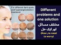 Home remedy for pigmentation dark spots and melasma all type skin problem2024hb beauty tips