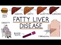 Understanding nonalcoholic fatty liver disease