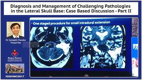 Challenging pathologies in the lateral skull base part: case discussion part 2