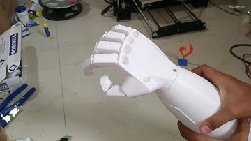 Robotic/Prosthetic Arm- Finger Movement via WiFi | Servo Motors | NodeMCU | ESP8266