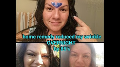 HOW-TO overnight get rid of wrinkle between eyes