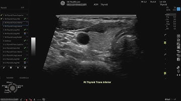 LOGIQ P9 Tutorials: Scan Assistant