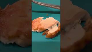 Chesters Chicken Racine Wi would you eat it ?