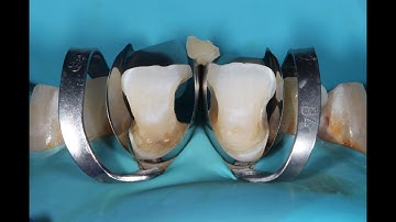 unica matrix application