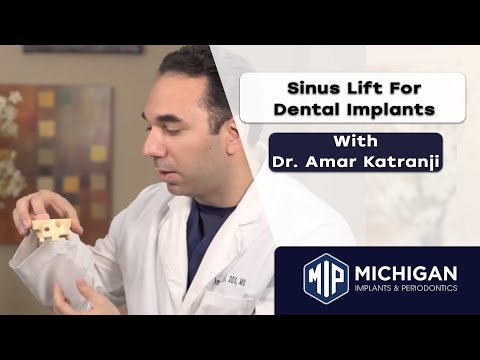 Dr. Katranji Discusses the Importance of Sinus Lifts for Dental Implant Placement