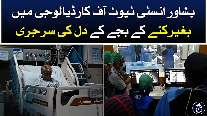 Child Heart Surgery without Cut in Peshawar Institute of Cardiology - Aaj News - Aaj News