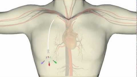 Central Lines 1: Introduction to Central Lines