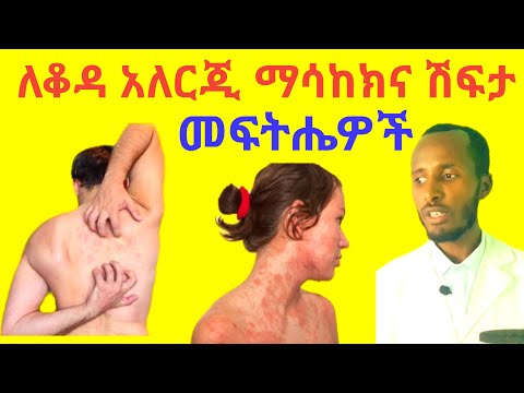 ቪዲዮ: Dyshidrotic Eczema ን እንዴት ማከም እንደሚቻል -12 ደረጃዎች (ከስዕሎች ጋር)