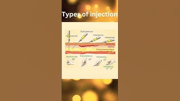 Types of Injections #intramuscularinjection #subcutaneous #intradermal #intravenous #aiapgetmcq