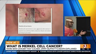 What is Merkel cell cancer?