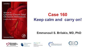 Case 160: Manual of CTO PCI - Stay calm and carry on
