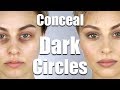 How To Conceal Dark Circles Under Eyes | Alexandra Anele