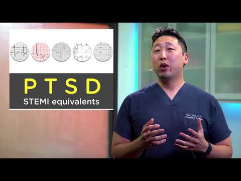 STEMI Equivalents for ECGs