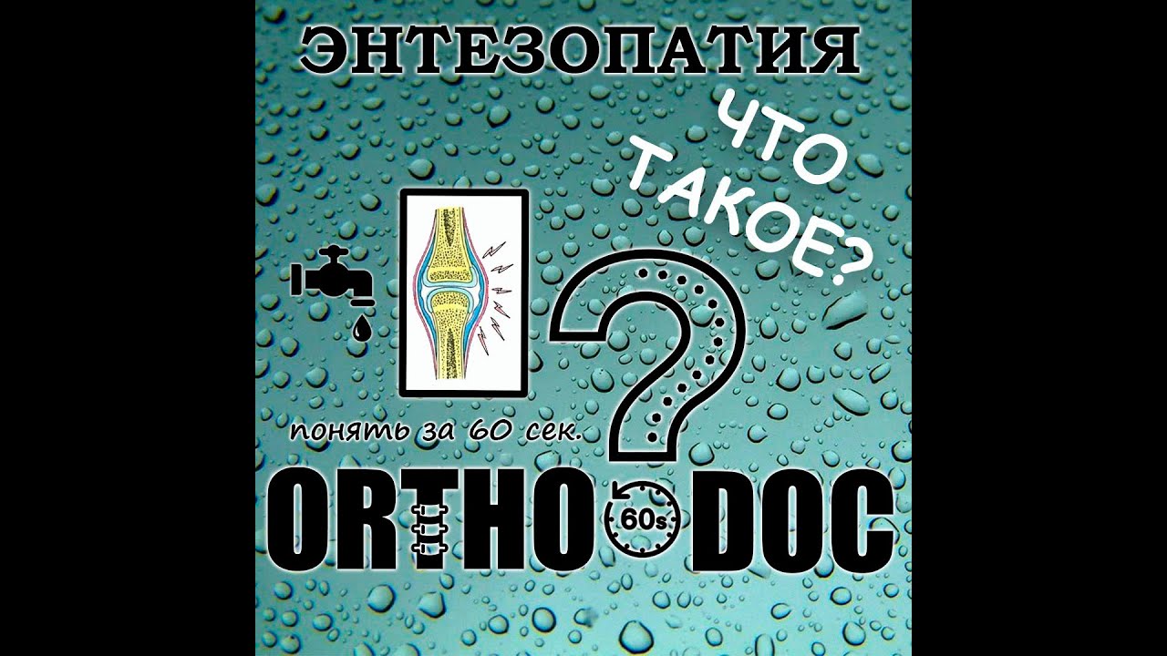 Понять за 60 секунд - Энтезопатии