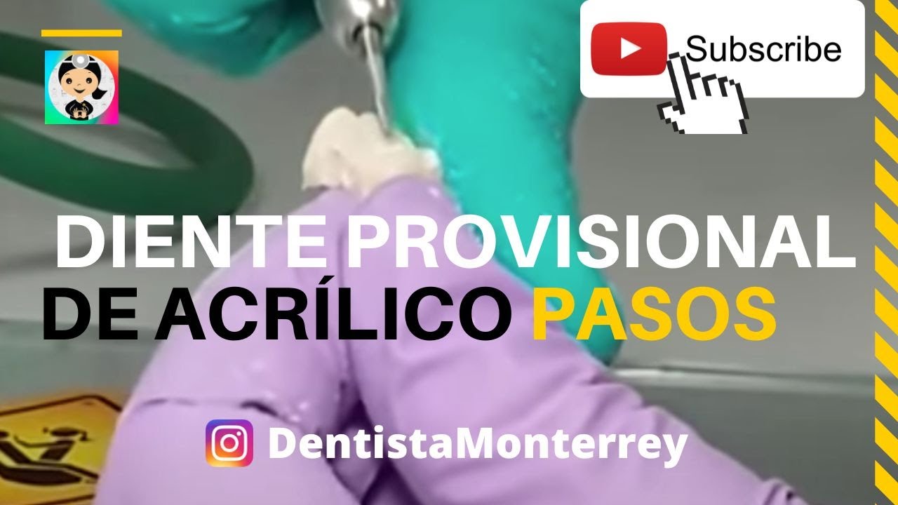 CORONA PROVISIONAL👅de Acrílico Autocurable dienteprovisional YouTube